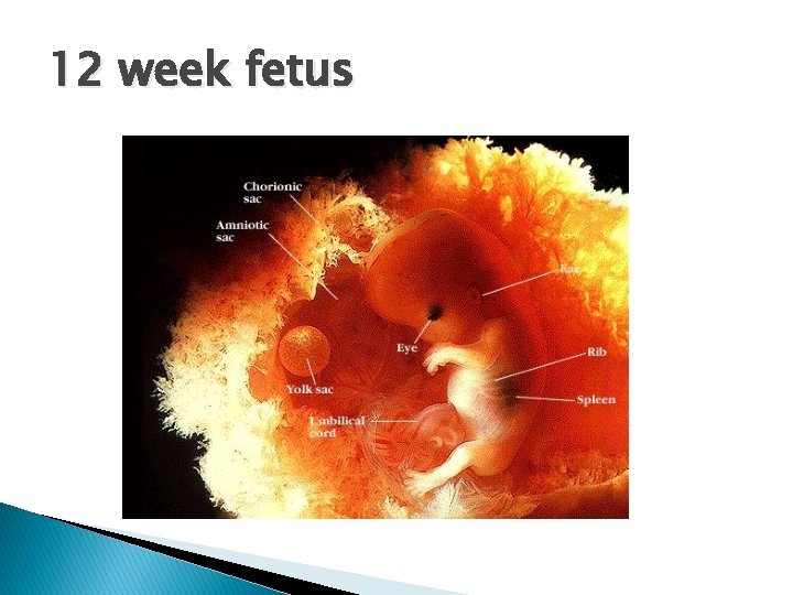 12 week fetus 
