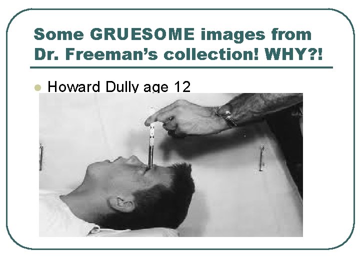 Some GRUESOME images from Dr. Freeman’s collection! WHY? ! l Howard Dully age 12