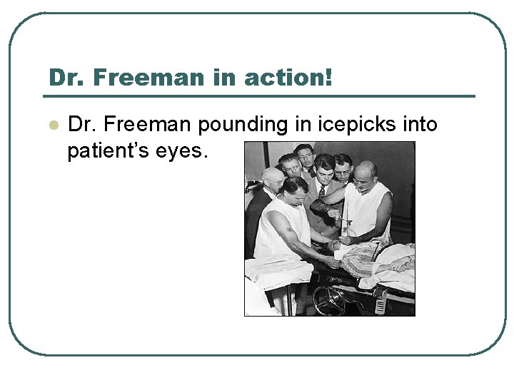 Dr. Freeman in action! l Dr. Freeman pounding in icepicks into patient’s eyes. 