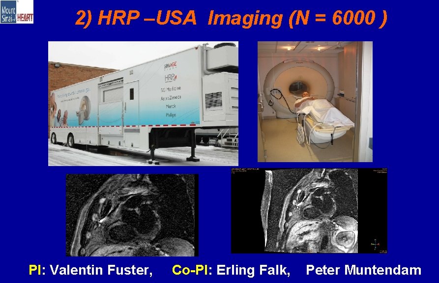 2) HRP –USA Imaging (N = 6000 ) First Mobile 3 T at Work