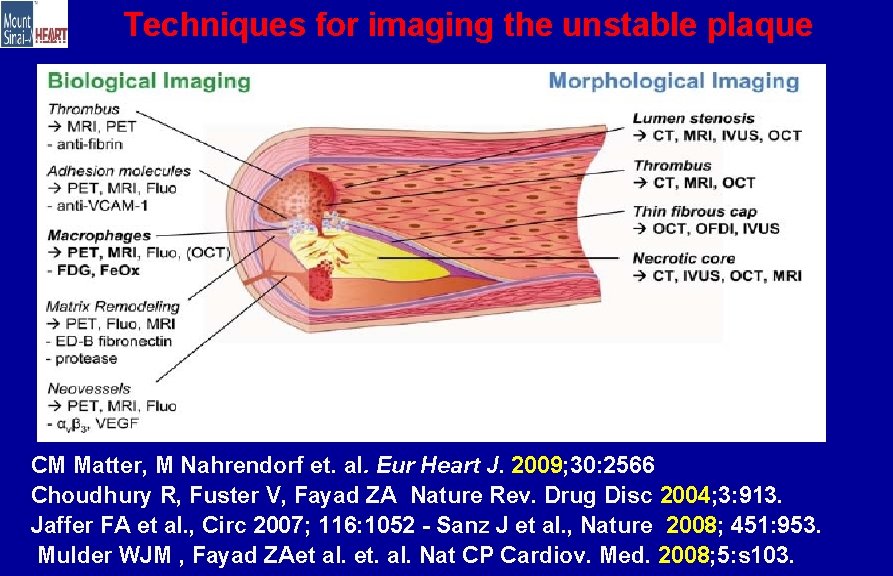 Techniques for imaging the unstable plaque CM Matter, M Nahrendorf et. al. Eur Heart