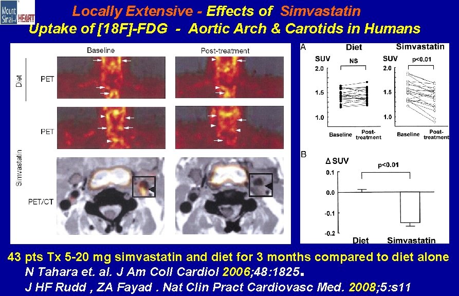 Locally Extensive - Effects of Simvastatin Uptake of [18 F]-FDG - Aortic Arch &