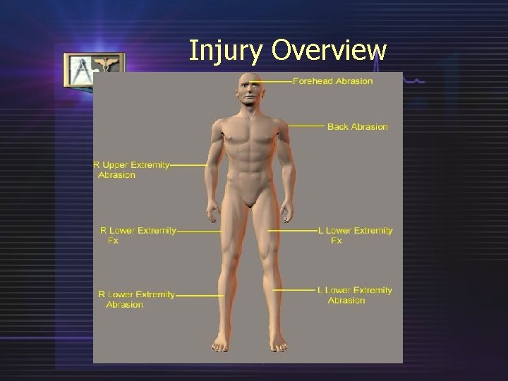 Injury Overview 