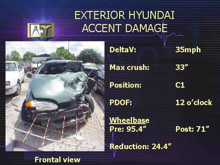 EXTERIOR HYUNDAI ACCENT DAMAGE Delta. V: 35 mph Max crush: 33” Position: C 1