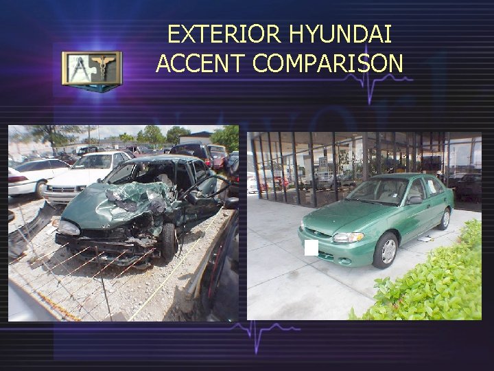 EXTERIOR HYUNDAI ACCENT COMPARISON 