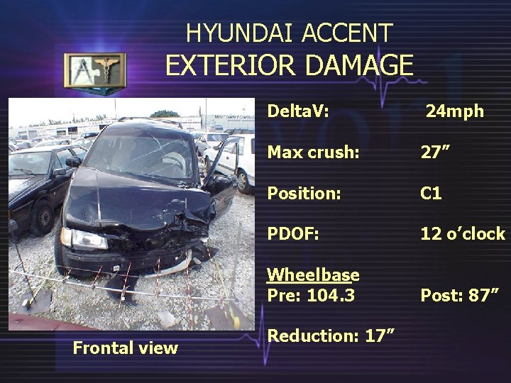 HYUNDAI ACCENT EXTERIOR DAMAGE Frontal view Delta. V: 24 mph Max crush: 27” Position: