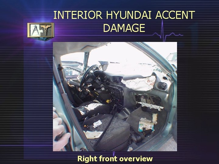 INTERIOR HYUNDAI ACCENT DAMAGE Right front overview 