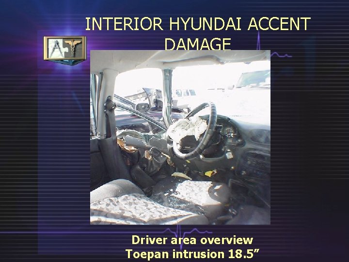 INTERIOR HYUNDAI ACCENT DAMAGE Driver area overview Toepan intrusion 18. 5” 