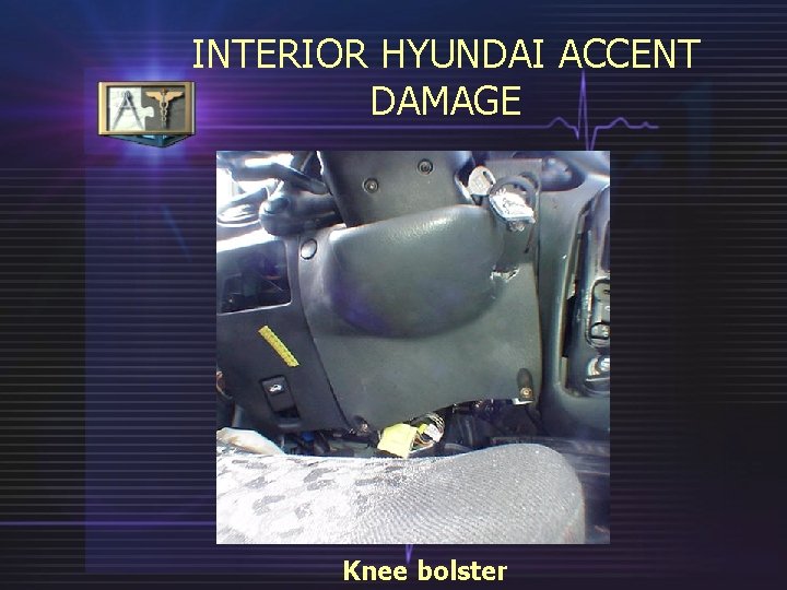 INTERIOR HYUNDAI ACCENT DAMAGE Knee bolster 