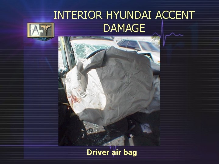INTERIOR HYUNDAI ACCENT DAMAGE Driver air bag 