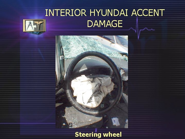 INTERIOR HYUNDAI ACCENT DAMAGE Steering wheel 