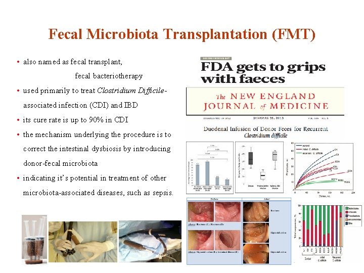 Fecal Microbiota Transplantation (FMT) • also named as fecal transplant, fecal bacteriotherapy • used