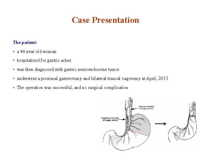 Case Presentation The patient: • a 44 -year old woman • hospitalized for gastric