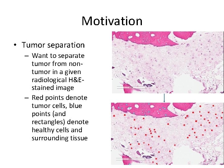 Motivation • Tumor separation – Want to separate tumor from nontumor in a given