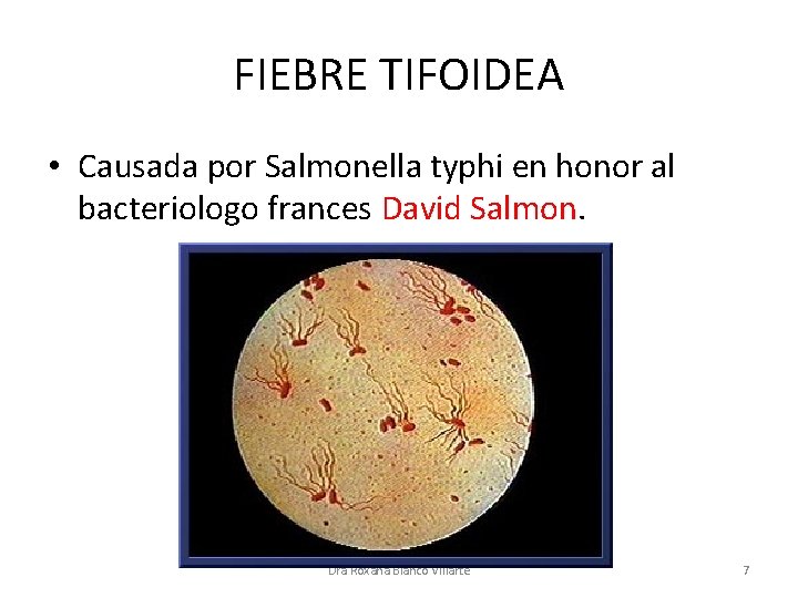 FIEBRE TIFOIDEA • Causada por Salmonella typhi en honor al bacteriologo frances David Salmon.