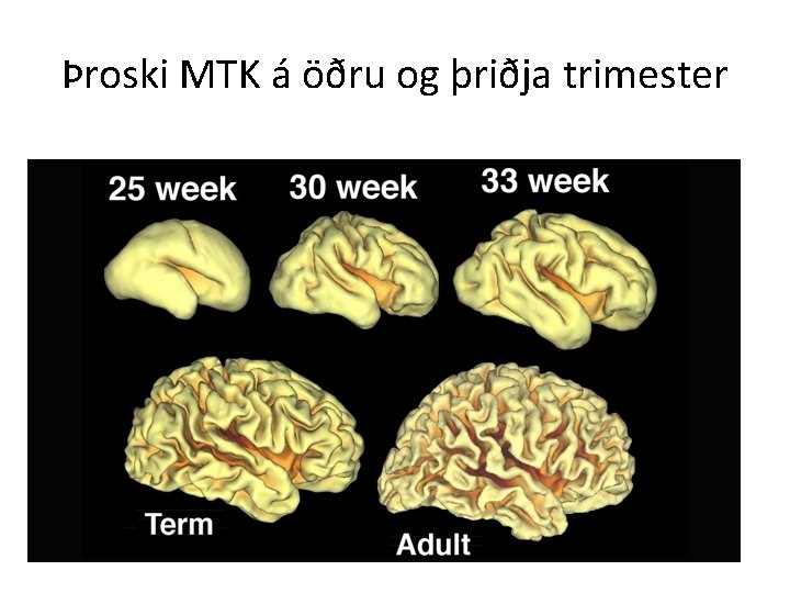 Þroski MTK á öðru og þriðja trimester 