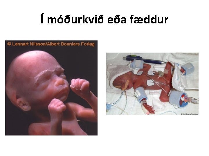 Í móðurkvið eða fæddur 