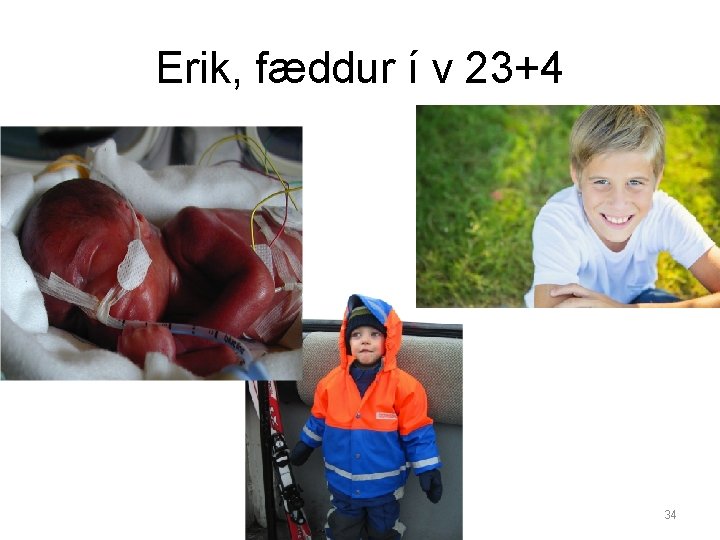 Erik, fæddur í v 23+4 • 24 v 34 