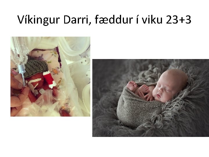 Víkingur Darri, fæddur í viku 23+3 