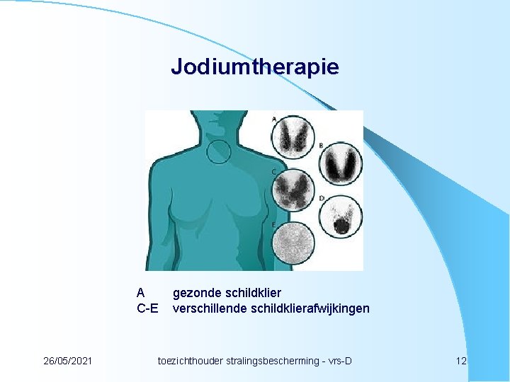 Jodiumtherapie A C-E 26/05/2021 gezonde schildklier verschillende schildklierafwijkingen toezichthouder stralingsbescherming - vrs-D 12 