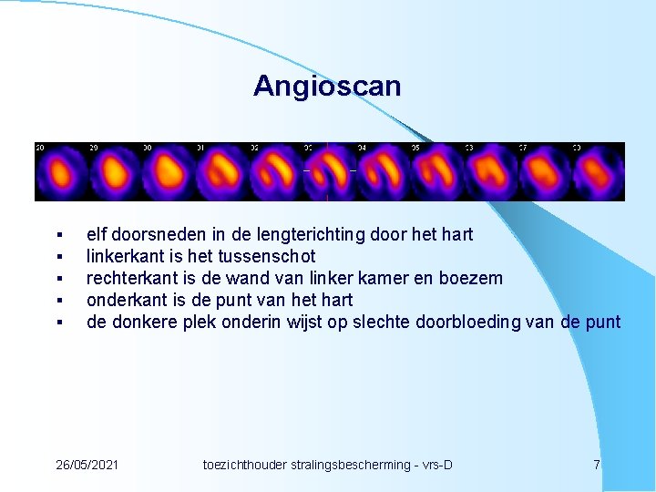 Angioscan § § § elf doorsneden in de lengterichting door het hart linkerkant is