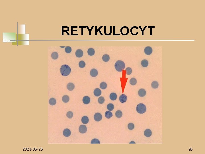 RETYKULOCYT 2021 -05 -25 26 