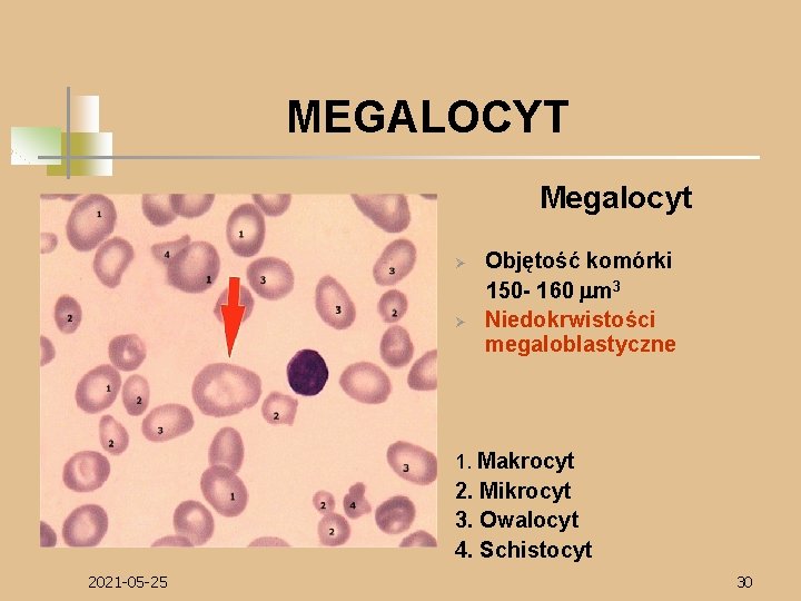 MEGALOCYT Megalocyt Ø Ø Objętość komórki 150 - 160 mm 3 Niedokrwistości megaloblastyczne 1.