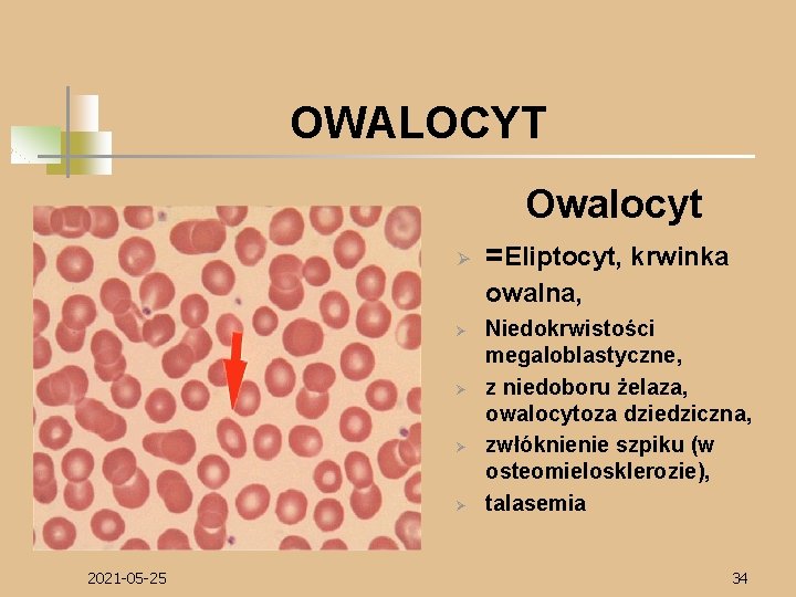 OWALOCYT Owalocyt Ø =Eliptocyt, krwinka owalna, Ø Ø 2021 -05 -25 Niedokrwistości megaloblastyczne, z