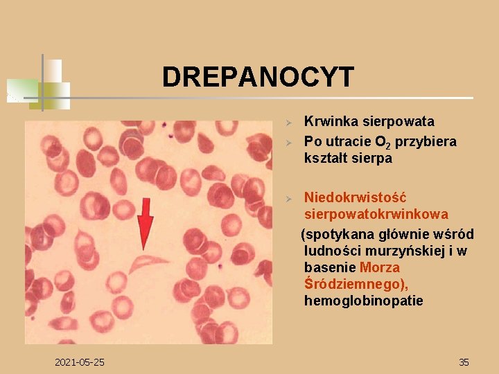 DREPANOCYT Ø Ø Ø 2021 -05 -25 Krwinka sierpowata Po utracie O 2 przybiera