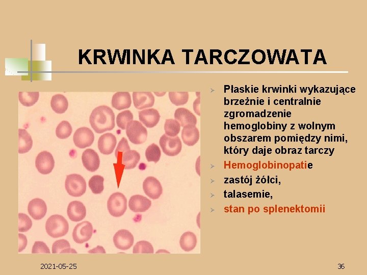 KRWINKA TARCZOWATA Ø Ø Ø 2021 -05 -25 Płaskie krwinki wykazujące brzeżnie i centralnie