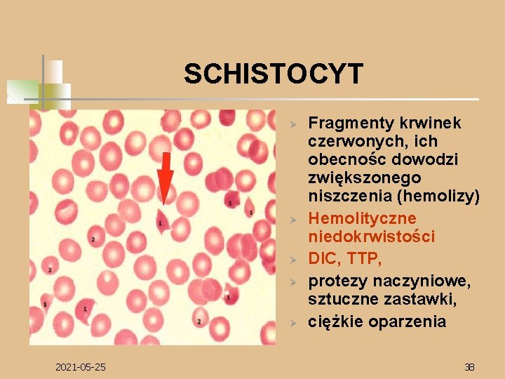 SCHISTOCYT Ø Ø Ø 2021 -05 -25 Fragmenty krwinek czerwonych, ich obecnośc dowodzi zwiększonego