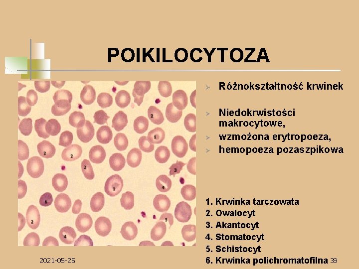 POIKILOCYTOZA Ø Ø 2021 -05 -25 Różnokształtność krwinek Niedokrwistości makrocytowe, wzmożona erytropoeza, hemopoeza pozaszpikowa