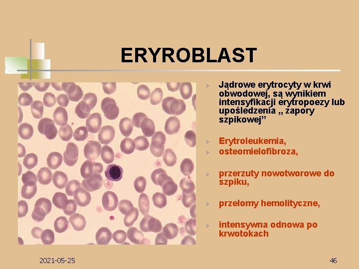 ERYROBLAST Ø Ø Ø 2021 -05 -25 Jądrowe erytrocyty w krwi obwodowej, są wynikiem