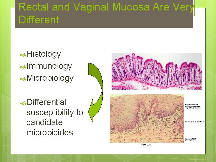 Rectal and Vaginal Mucosa Are Very Different Histology Immunology Microbiology Differential susceptibility to candidate