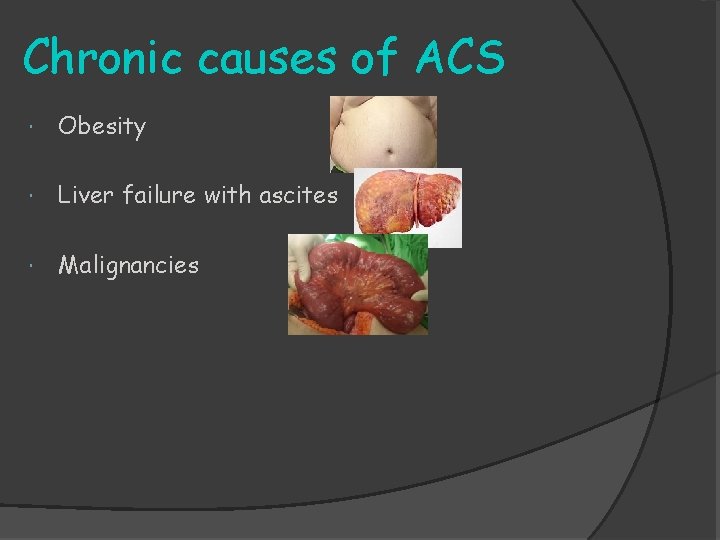 Chronic causes of ACS Obesity Liver failure with ascites Malignancies 