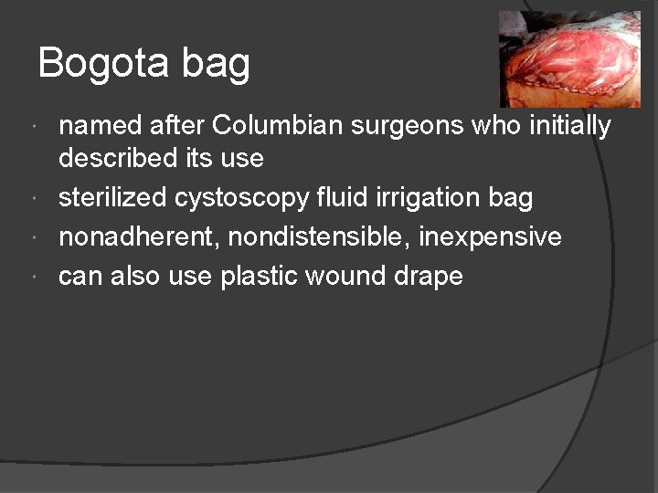 Bogota bag named after Columbian surgeons who initially described its use sterilized cystoscopy fluid