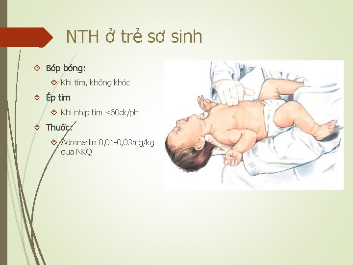 NTH ở trẻ sơ sinh Bóp bóng: Khi tím, không khóc Ép tim Khi
