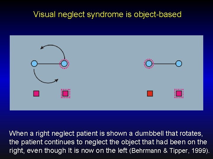 Visual neglect syndrome is object-based When a right neglect patient is shown a dumbbell
