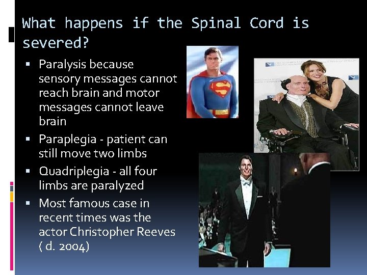 What happens if the Spinal Cord is severed? Paralysis because sensory messages cannot reach