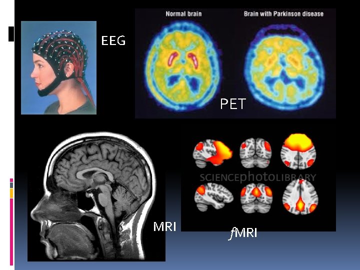EEG PET MRI f. MRI 
