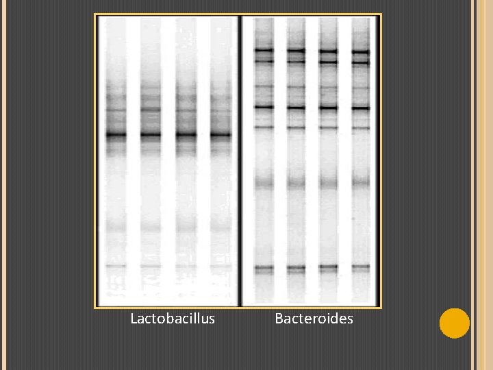 Lactobacillus Bacteroides 