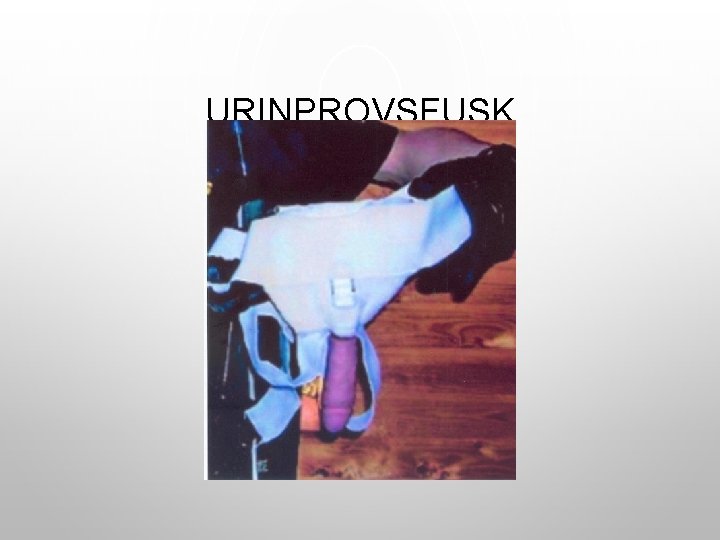 URINPROVSFUSK 