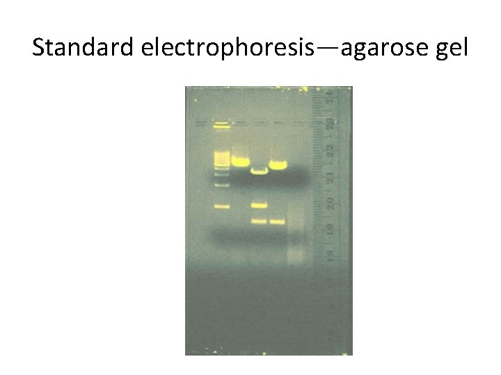 Standard electrophoresis—agarose gel 