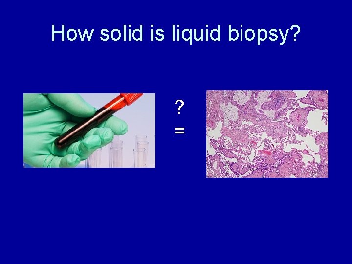 How solid is liquid biopsy? ? = 