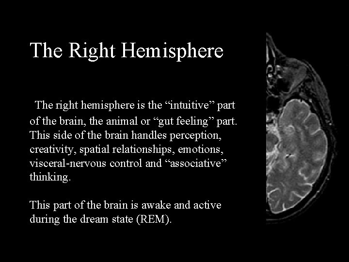 The Right Hemisphere The right hemisphere is the “intuitive” part of the brain, the
