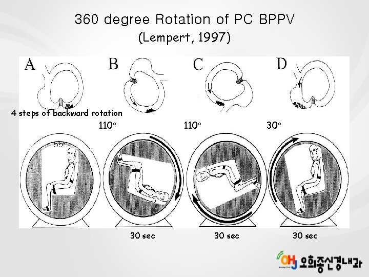 360 degree Rotation of PC BPPV (Lempert, 1997) 4 steps of backward rotation 110