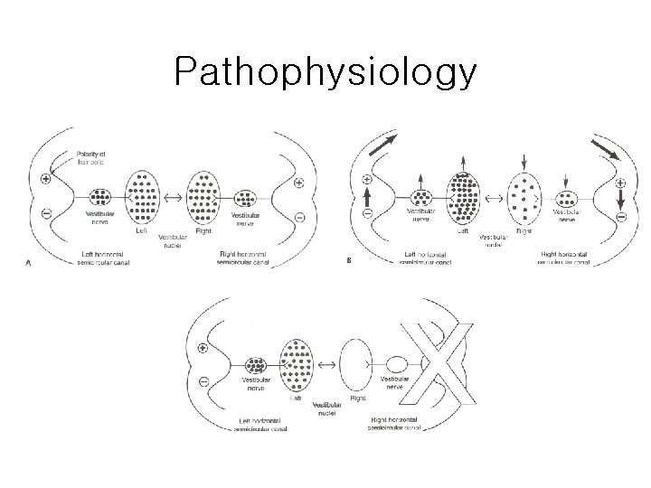 Pathophysiology 