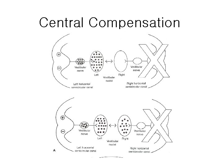 Central Compensation 