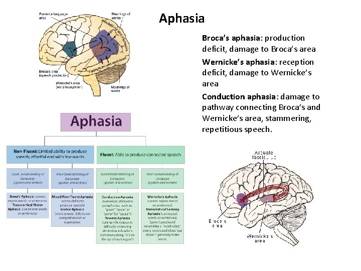 Aphasia Broca’s aphasia: production deficit, damage to Broca’s area Wernicke’s aphasia: reception deficit, damage Aphasia Broca’s aphasia: production deficit, damage to Broca’s area Wernicke’s aphasia: reception deficit, damage