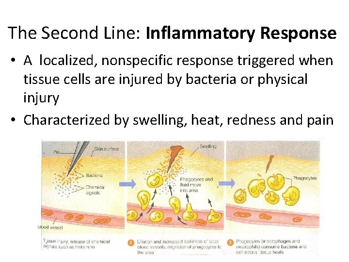 The Second Line: Inflammatory Response • A localized, nonspecific response triggered when tissue cells
